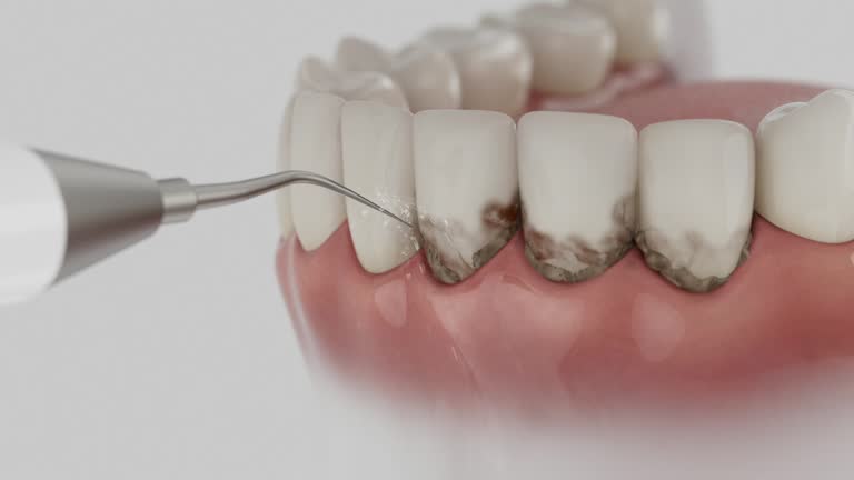 Trusted Wisdom Tooth Removal service in Camden, AR - Dentist Open Now
